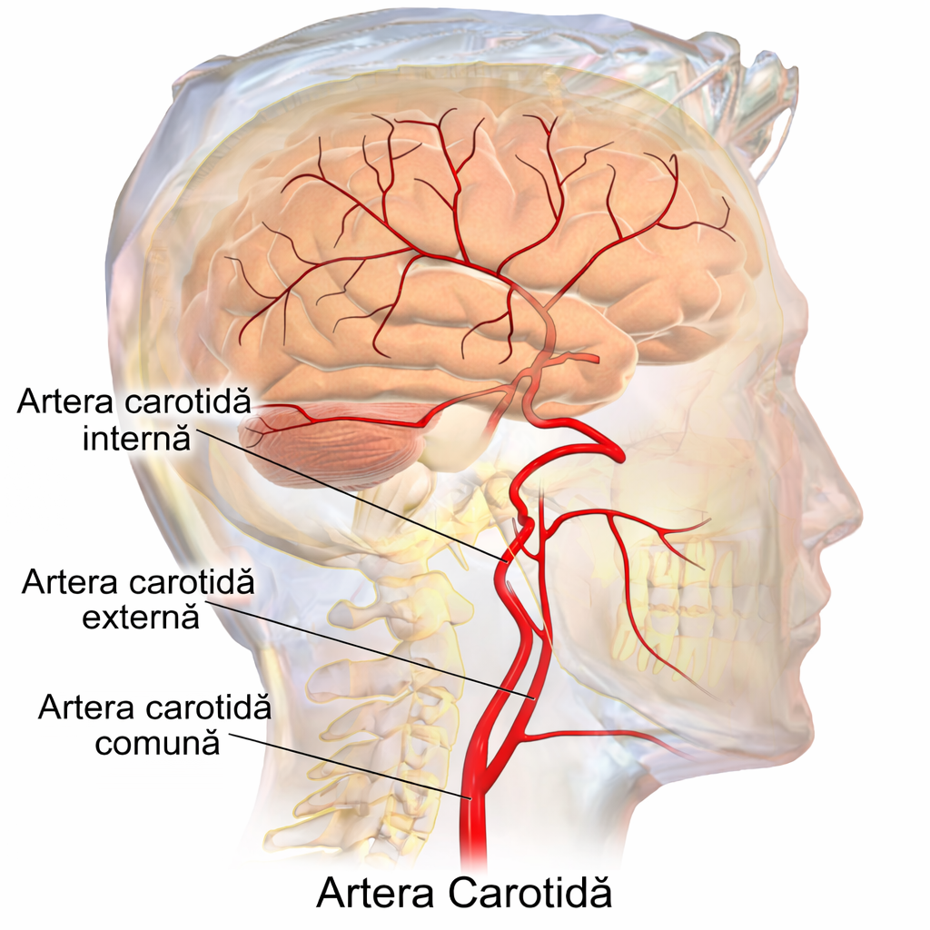 Stentarea carotidiană și anatomia arterelor carotide: bifurcația carotidei comune în carotida internă și externă