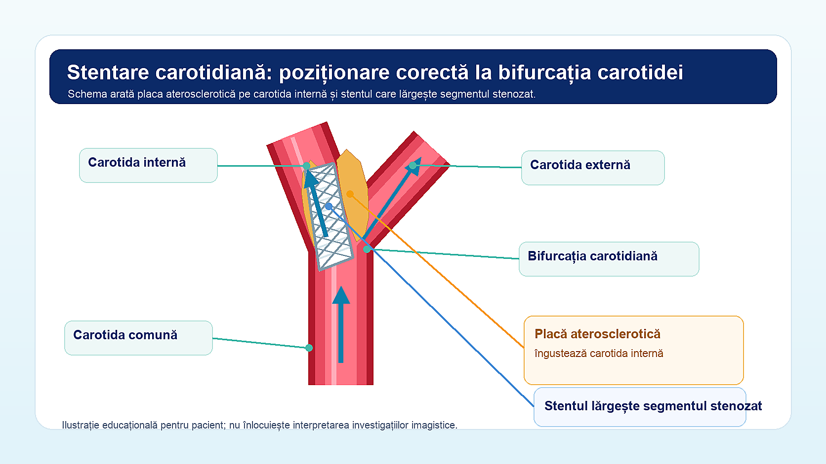 stenoză carotidiană și stenoză de arteră vertebrală evaluare neurochirurgicală Chișinău